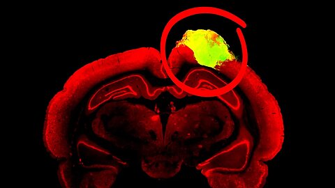 Human Brain Piece Transplanted Into Rats | And it WORKED