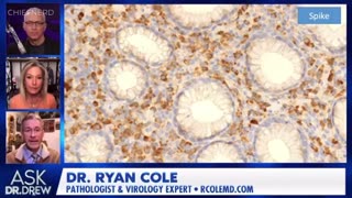 💥💉 Dr. Ryan Cole Shares Terrifying Biopsy Results Which Could Explain Rise in Cancers ~ Full Video Link and other Dr. Cole Videos in the Description 👇