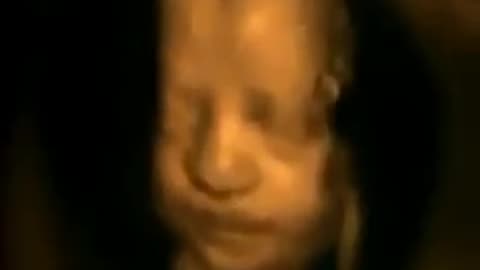 Incredible Video Shows Unborn Babies Jumping Around, Waving, Yawning and Sucking Their Thumb
