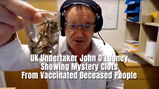 UK Undertaker John O’Looney Showing Mystery Clots From Vaccinated Deceased People