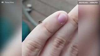Homem filma aranha atacando vespa no próprio dedo