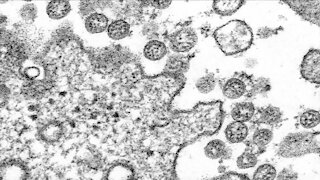 Colorado officials identify first known US case of COVID-19 variant seen in UK