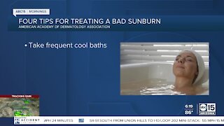 The BULLetin Board: Treating a bad sunburn