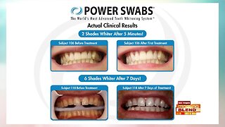 Get Cleaner, Whiter Teeth...Fast!