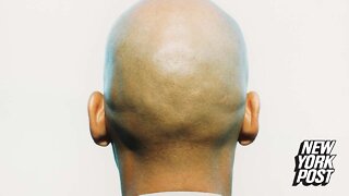 Calling men 'bald' counts as sexual harassment on the job, UK judges rule