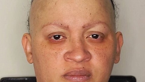 Mom Suffering From Alopecia Receives Amazing Makeover Transformation