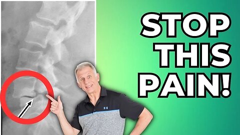 Spondylolisthesis, 3 Best Pain Stoppers & Guide To Pain Free Living