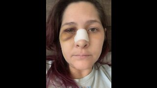 Woman brutally attacked outside Encinitas bar