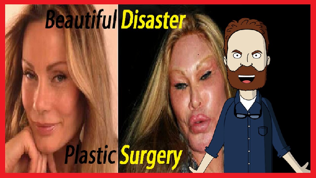 Bad Plastic Surgery Botched Craziest Plastic Surgeries Plastic Surgery Gone Wrong Disaster