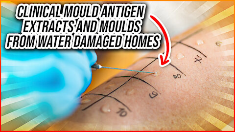 Clinical Mould Antigen Extracts and Moulds From Water-Damaged Homes