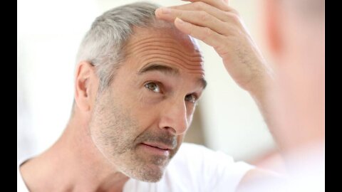 DHT and it's role in hair loss