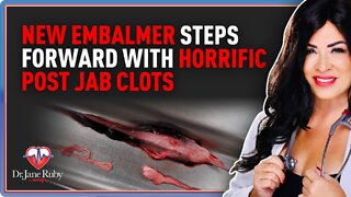New Embalmer Steps Forward With Horrific Post Jab Clots