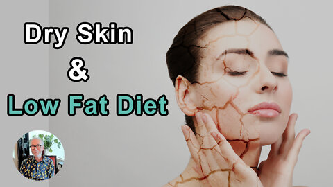 Do People Develop Dry Skin On A Low-Fat Diet? - John McDougall, MD