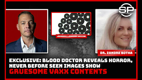 Never Before Seen: Blood Doctor Reveals HORRIFIC Findings After Examining Vials