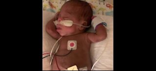 Baby hears mother's voice for the first time