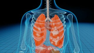 COVID-19 AND LUNG CANCER