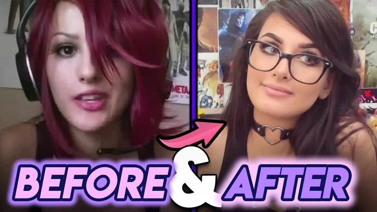 Sssniperwolf Before And After Plastic Surgery Rumours And Transformation