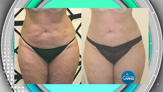 Absolute Beauty Solutions - Weight Loss that Works for You