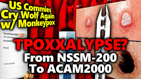 No Mention of Impaired Sperm or Deadly Shedding?! Media Pushes TPOXX & US' 100M Doses Of ACAM2000