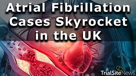 Atrial Fibrillation Cases Skyrocket in the UK—1 in 45 Now Live with Condition