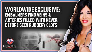 Worldwide Exclusive: Embalmers Find Veins & Arteries Filled with Never Before Seen Rubbery Clots