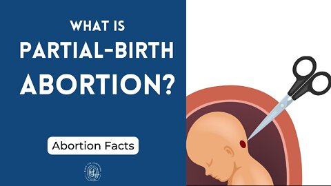 What's Partial-Birth Abortion?