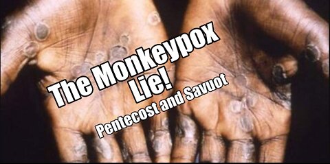 The Monkeypox Lie! Pentecost and Shavuot Teaching. B2t Show Jun 4, 2022