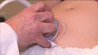 Milwaukee area obstetrician urges pregnant Wisconsinites to get vaccinated