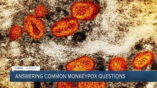 Local health expert talks about spread of Monkeypox