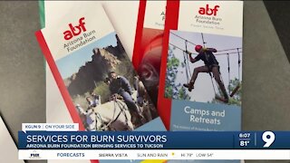 Arizona Burn Foundation bringing services to Tucson