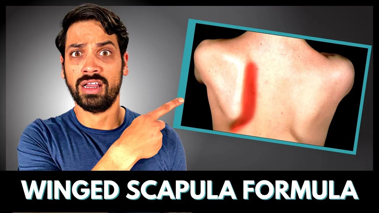 The Hidden Cause Of Scapular Winging | Fix It In 3 Steps