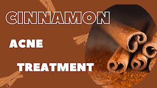 Cinnamon Acne Treatment