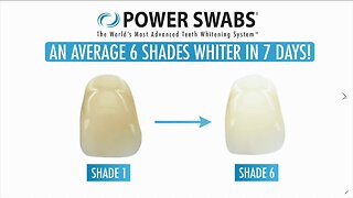 You Can Have Whiter Brighter Teeth with Power Swabs