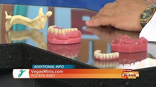 Mini Dental Implants Providing A Bright Smile
