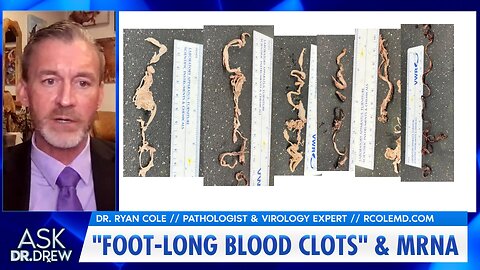 "Foot-Long Blood Clots" From mRNA, Says Pathologist Dr. Ryan Cole w/ Dr Kelly Victory – Ask Dr. Drew