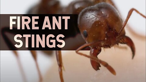 Fire Ant Stings Explained by Sticking My Leg in an ANT NEST!