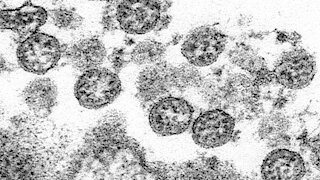 CDC Quietly Updates Guidance On Coronavirus Transmission