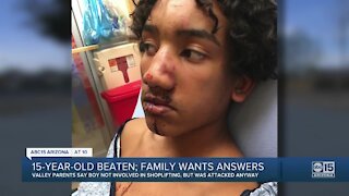 Valley 15-year-old beaten; family wants answers