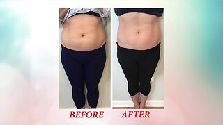 Remove Stubborn Fat Without Surgery