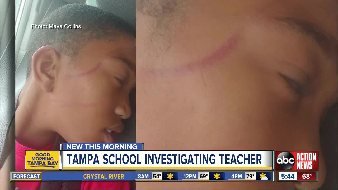 Tampa school investigating special needs teacher accused of physically abusing student