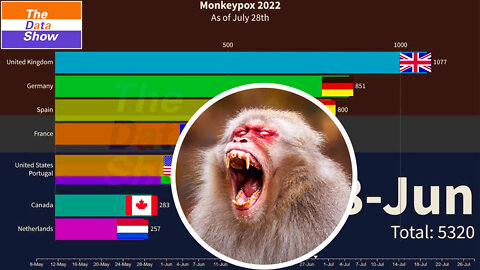 🏎Bar Chart Race: Monkeypox 2022 As of July 28th 🟠⚪🟣 The Data Show