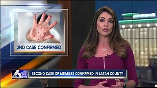 Second measles case confirmed in Idaho