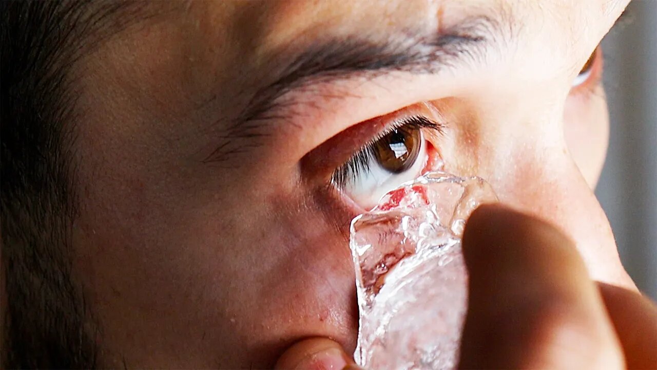 What Happens If You Put ICE On Your EYEBALLS 