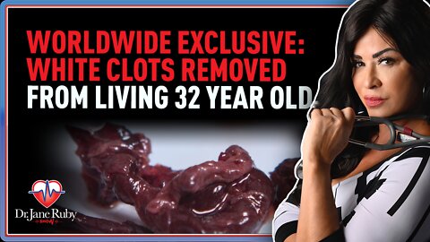 Dr. Jane Ruby: Worldwide Exclusive: White Clots Removed From Living 32 Year Old