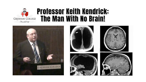 Professor Keith Kendrick: The Man With No Brain!