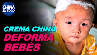 Producto chino causa deformidades en bebés. Aparecen secuelas en casi todos los pacientes del virus