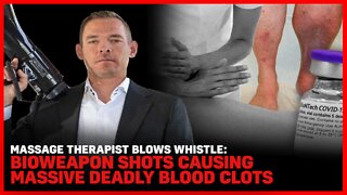 Massage Therapist Blows Whistle: Bioweapon Shots Causing Massive Deadly Blood Clots