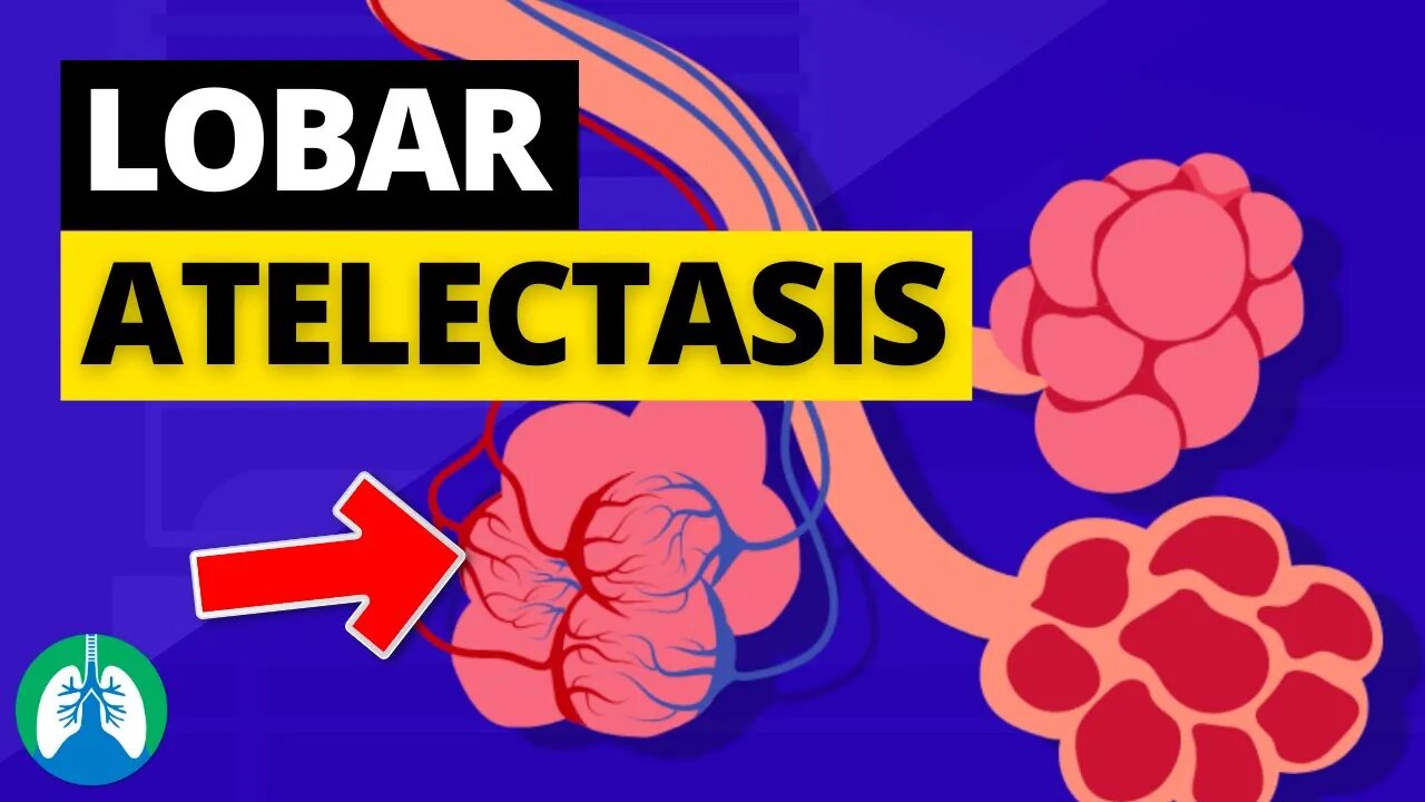 lobar-atelectasis-medical-definition-quick-explainer-video