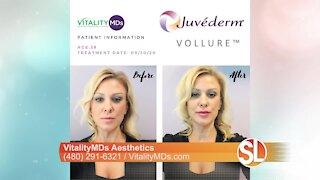VitalityMDs Aesthetics: Popular injectable treatments to help you look AMAZING!