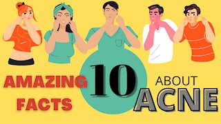 10 Amazing Facts About Acne that you may never have known